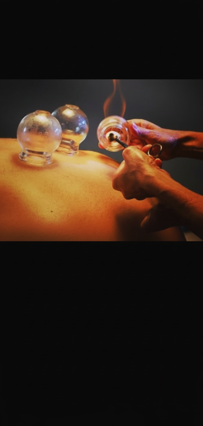 Fire Cupping